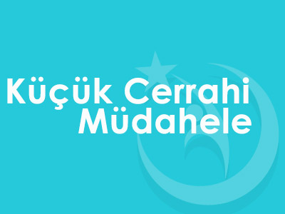 Küçük Cerrahi Müdahele